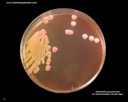 deoxycholate citrate agar klebsiella
